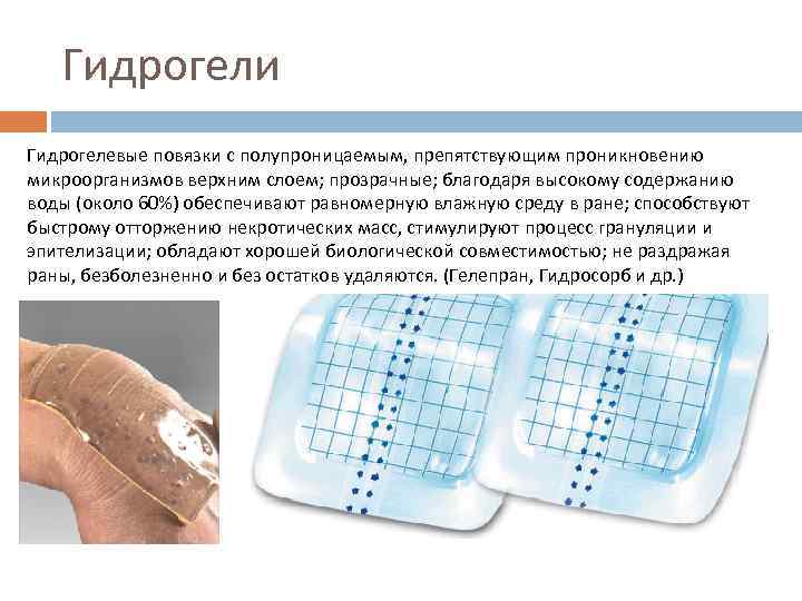 Гидрогели Гидрогелевые повязки с полупроницаемым, препятствующим проникновению микроорганизмов верхним слоем; прозрачные; благодаря высокому содержанию