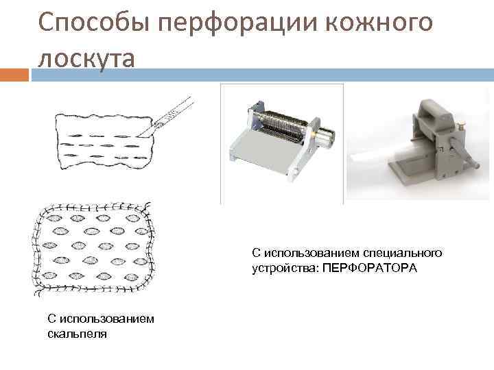 Способы перфорации кожного лоскута С использованием специального устройства: ПЕРФОРАТОРА С использованием скальпеля 