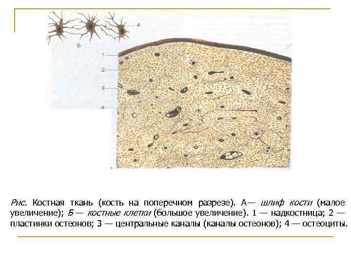 Кости костной ткани. Пластинчатая костная ткань поперечный шлиф. Пластинчатая костная ткань шлиф кости. Пластинчатая костная ткань поперечный шлиф гистология. Костная ткань шлиф кости строение.