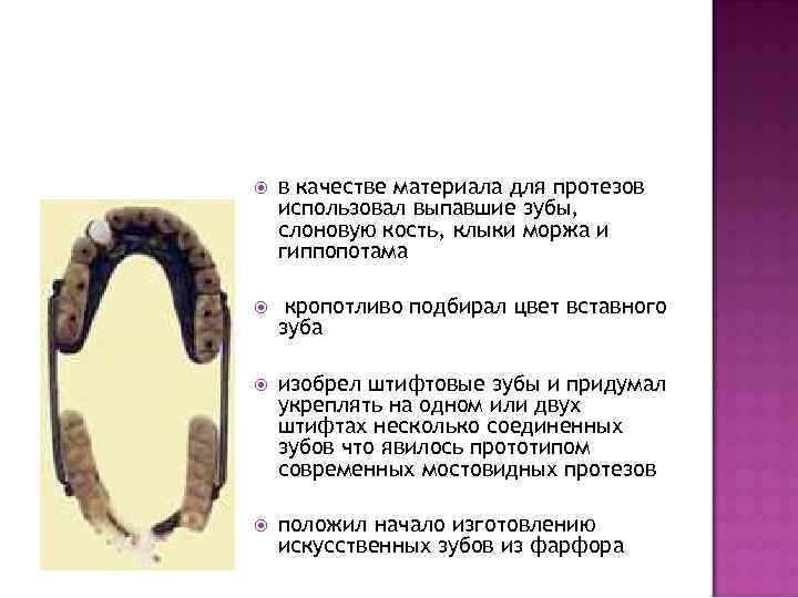  в качестве материала для протезов использовал выпавшие зубы, слоновую кость, клыки моржа и
