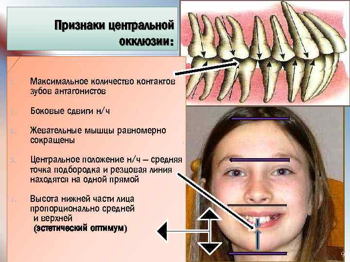 Признаки центральной. Признаки центральной окклюзии. Центральная окклюзия определяется признаками. Центральная окклюзия характеризуется. Центральная окклюзия признаки характеризующие центральную.