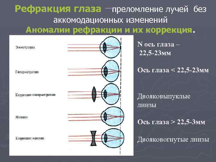 Схема хода параллельного пучка лучей дальнозоркого глаза