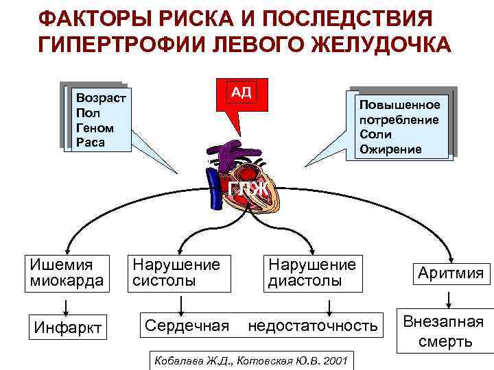 ФАКТОРЫ РИСКА И ПОСЛЕДСТВИЯ ГИПЕРТРОФИИ ЛЕВОГО ЖЕЛУДОЧКА АД Возраст Пол Геном Раса Повышенное потребление