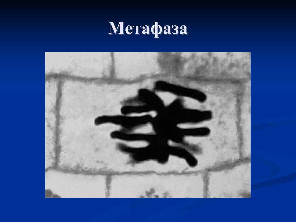 Метафаза 