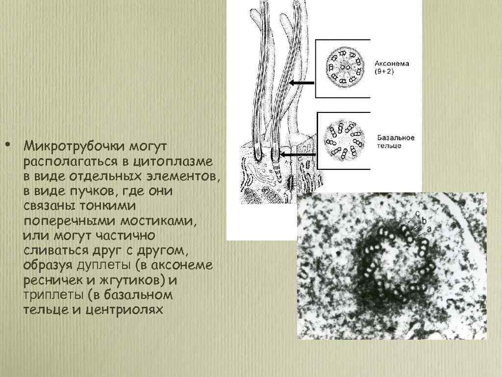  • Микротрубочки могут располагаться в цитоплазме в виде отдельных элементов, в виде пучков,