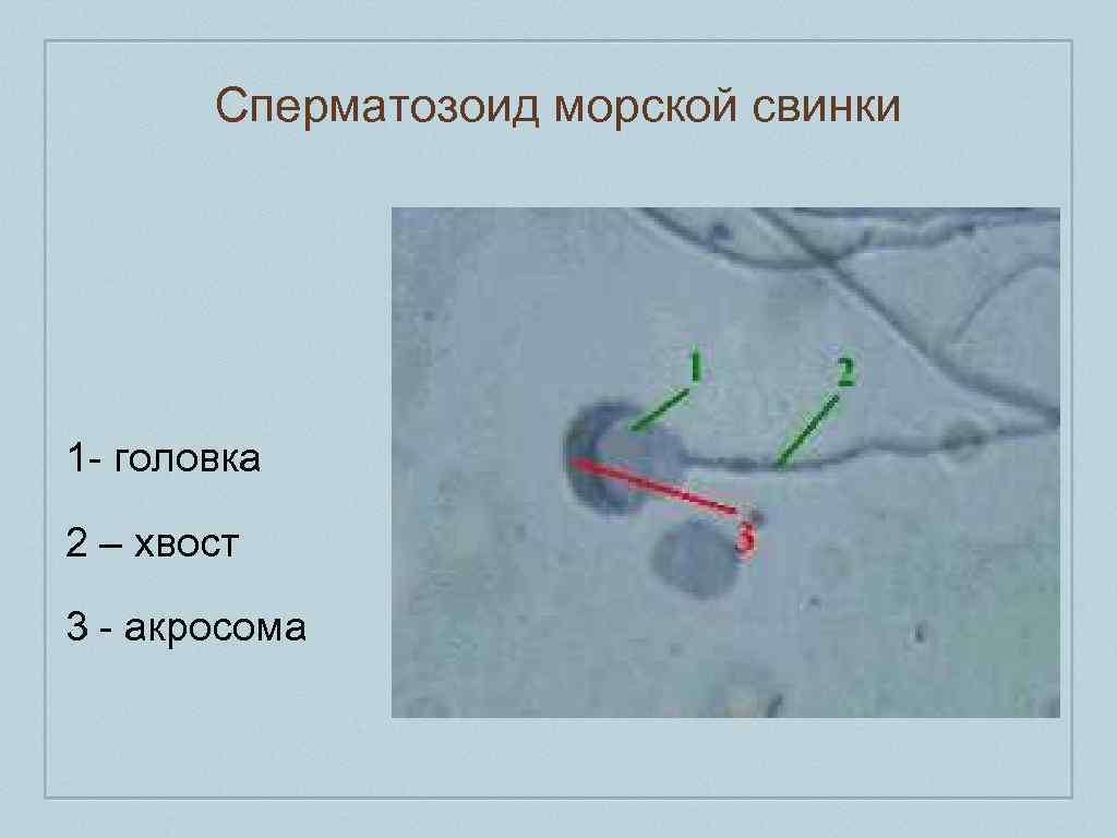 Сперматозоид морской свинки 1 - головка 2 – хвост 3 - акросома 