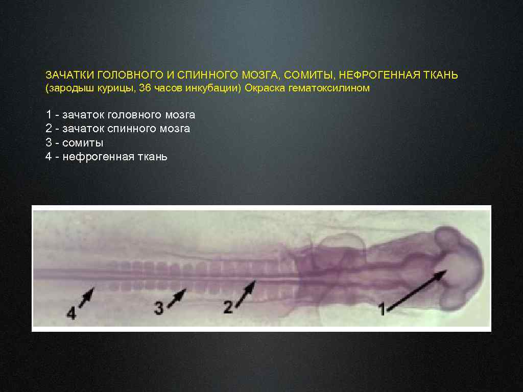 ЗАЧАТКИ ГОЛОВНОГО И СПИННОГО МОЗГА, СОМИТЫ, НЕФРОГЕННАЯ ТКАНЬ (зародыш курицы, 36 часов инкубации) Окраска