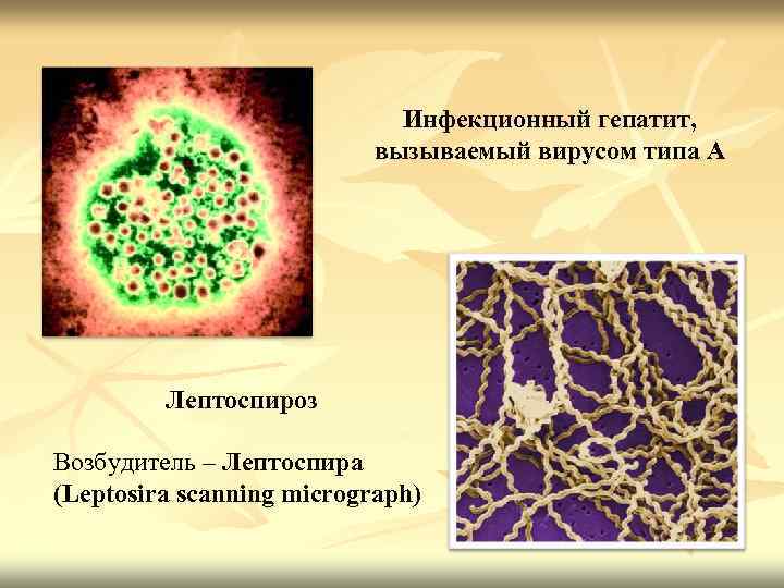 Инфекционный гепатит, вызываемый вирусом типа А Лептоспироз Возбудитель – Лептоспира (Leptosira scanning micrograph) 