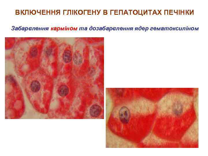 ВКЛЮЧЕННЯ ГЛІКОГЕНУ В ГЕПАТОЦИТАХ ПЕЧІНКИ Забарвлення карміном та дозабарвлення ядер гематоксиліном 