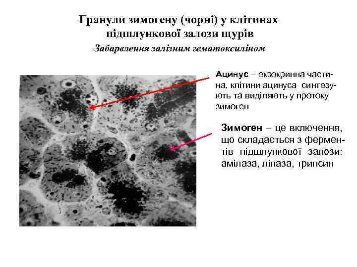 Гранули зимогену (чорні) у клітинах підшлункової залози щурів Забарвлення залізним гематоксиліном Ацинус – екзокринна