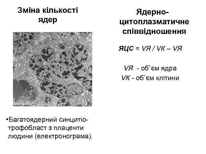 Зміна кількості ядер Ядерноцитоплазматичне співвідношення ЯЦС = VЯ / VК – VЯ - об`єм