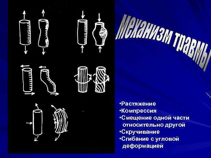  • Растяжение • Компрессия • Смещение одной части относительно другой • Скручивание •