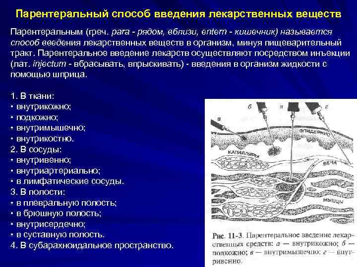 Парентеральный способ введения лекарственных веществ Парентеральным (греч. para - рядом, вблизи, entern - кишечник)