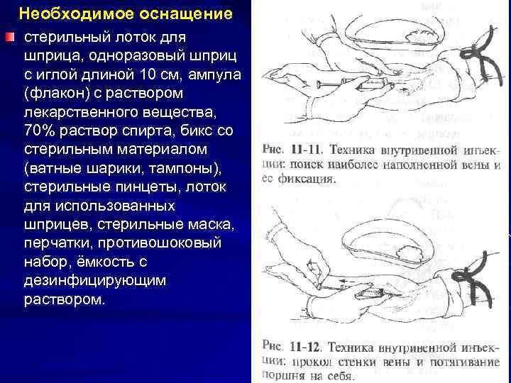 Необходимое оснащение стерильный лоток для шприца, одноразовый шприц с иглой длиной 10 см, ампула