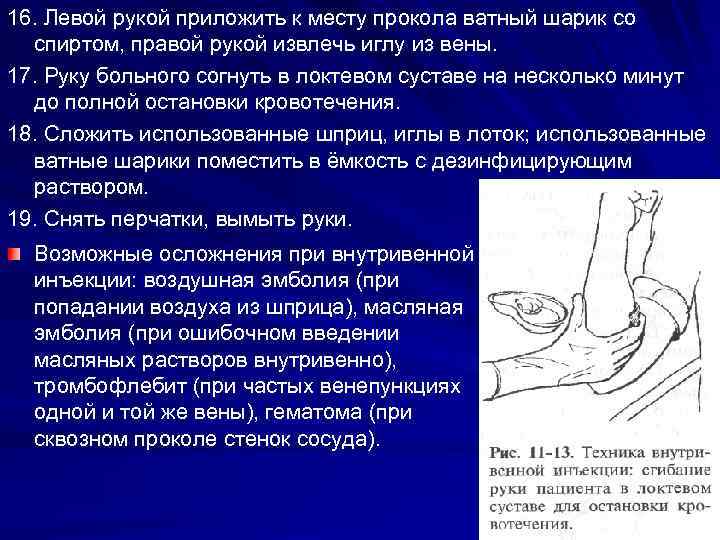 16. Левой рукой приложить к месту прокола ватный шарик со спиртом, правой рукой извлечь