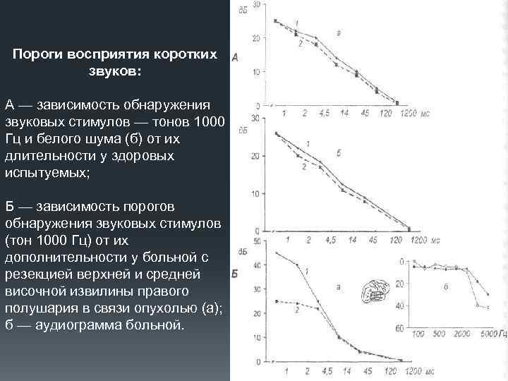 Пороги восприятия коротких звуков: А — зависимость обнаружения звуковых стимулов — тонов 1000 Гц