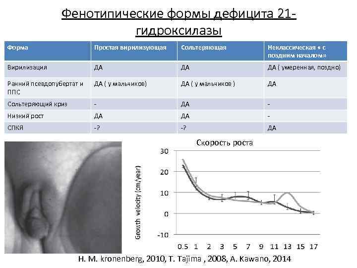Фенотипические формы дефицита 21 гидроксилазы Форма Простая вирилизующая Сольтеряющая Неклассическая « с поздним началом»