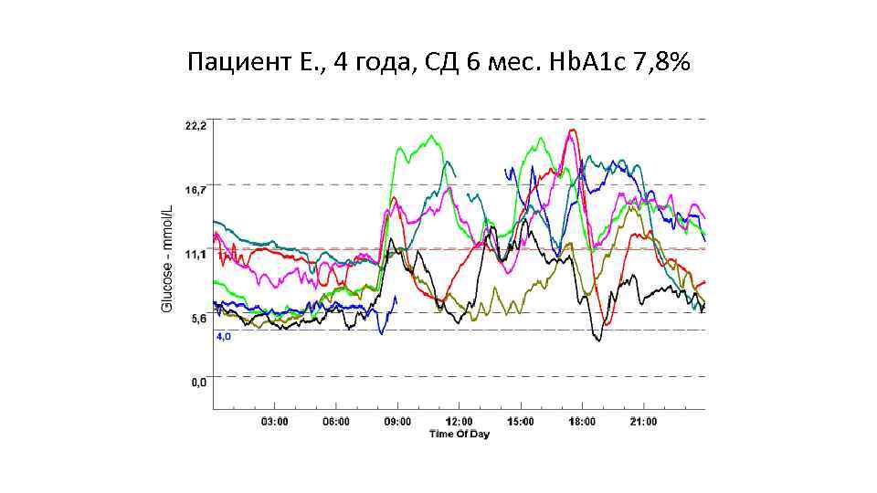 Пациент Е. , 4 года, СД 6 мес. Hb. A 1 c 7, 8%