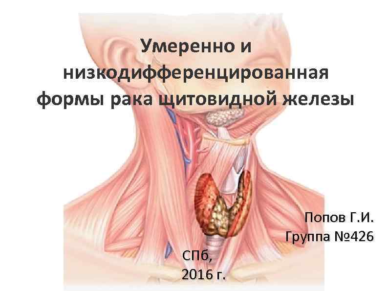 Умеренно и низкодифференцированная формы рака щитовидной железы СПб, 2016 г. Попов Г. И. Группа