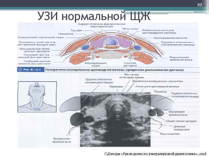 19 УЗИ нормальной ЩЖ С. Делорм «Руководство по ультразвуковой диагностике» , 2016 