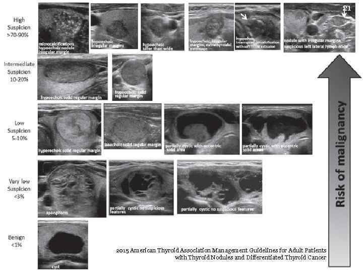 21 2015 American Thyroid Association Management Guidelines for Adult Patients with Thyroid Nodules and