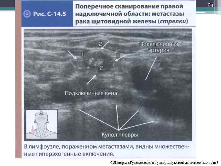 24 С. Делорм «Руководство по ультразвуковой диагностике» , 2016 