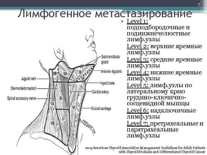 Лимфогенное метастазирование 7 • Level 1: подподбородочные и поднижнечелюстные лимф. узлы • Level 2: