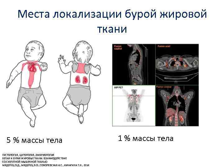Места локализации бурой жировой ткани 5 % массы тела ГИСТОЛОГИЯ, ЦИТОЛОГИЯ, ЭМБРИОЛОГИЯ БЕЛАЯ И