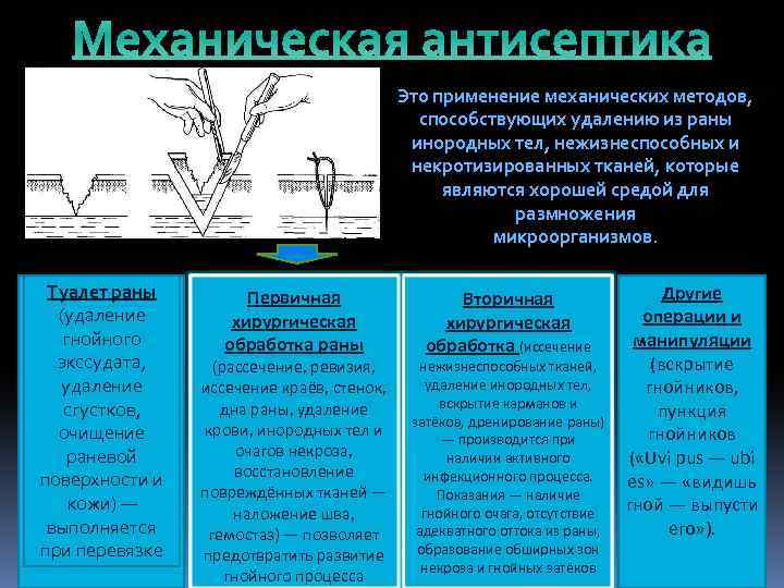 Механическая антисептика Это применение механических методов, способствующих удалению из раны инородных тел, нежизнеспособных и