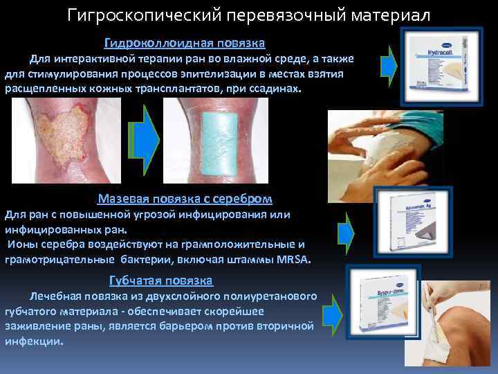 Гигроскопический перевязочный материал Гидроколлоидная повязка Для интерактивной терапии ран во влажной среде, а также