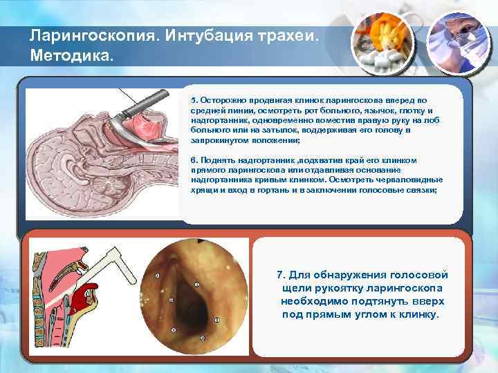 Ларингоскопия. Интубация трахеи. Методика. 5. Осторожно продвигая клинок ларингоскопа вперед по средней линии, осмотреть