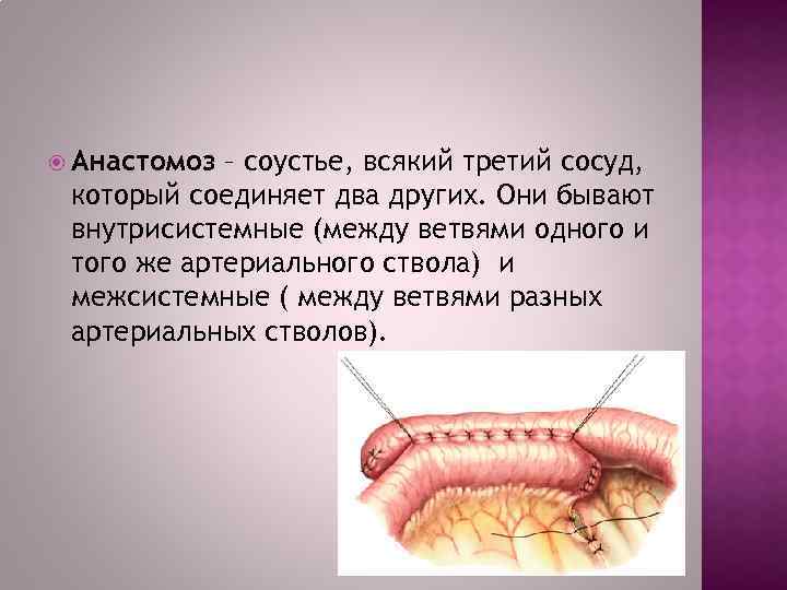  Анастомоз – соустье, всякий третий сосуд, который соединяет два других. Они бывают внутрисистемные