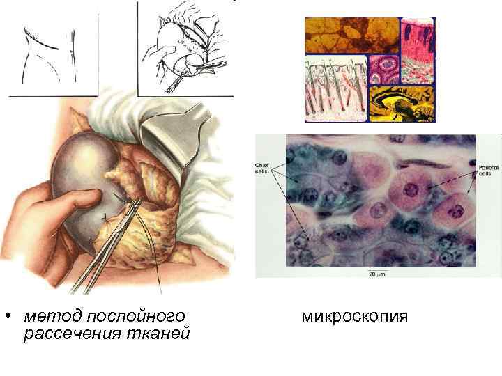  • метод послойного рассечения тканей микроскопия 