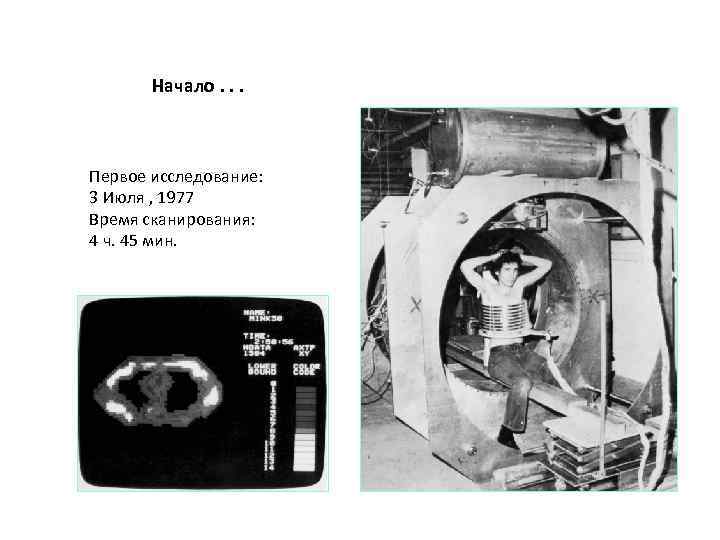 Начало. . . Первое исследование: 3 Июля , 1977 Время сканирования: 4 ч. 45