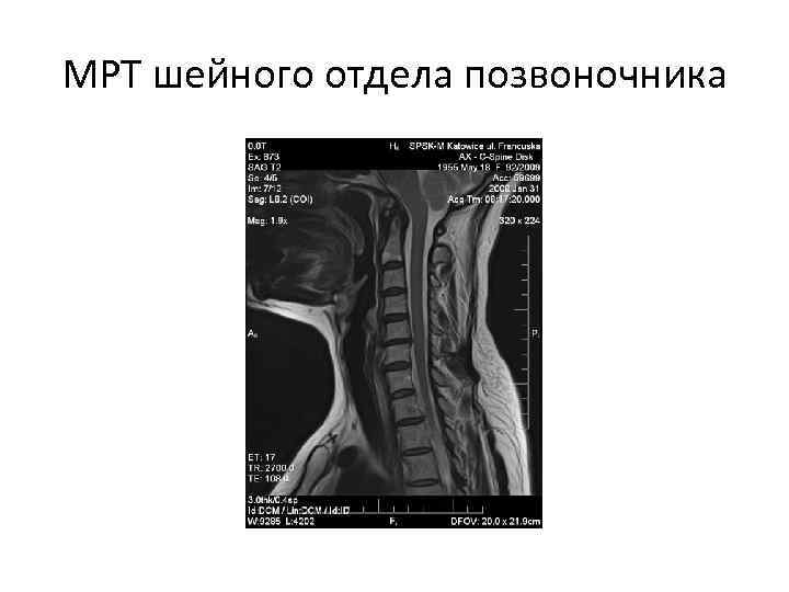 Отделы позвоночника для мрт схема фото и названия