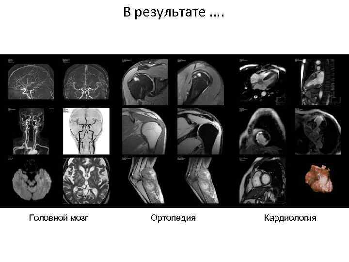 В результате …. Головной мозг Ортопедия Кардиология XGV/ZGV 