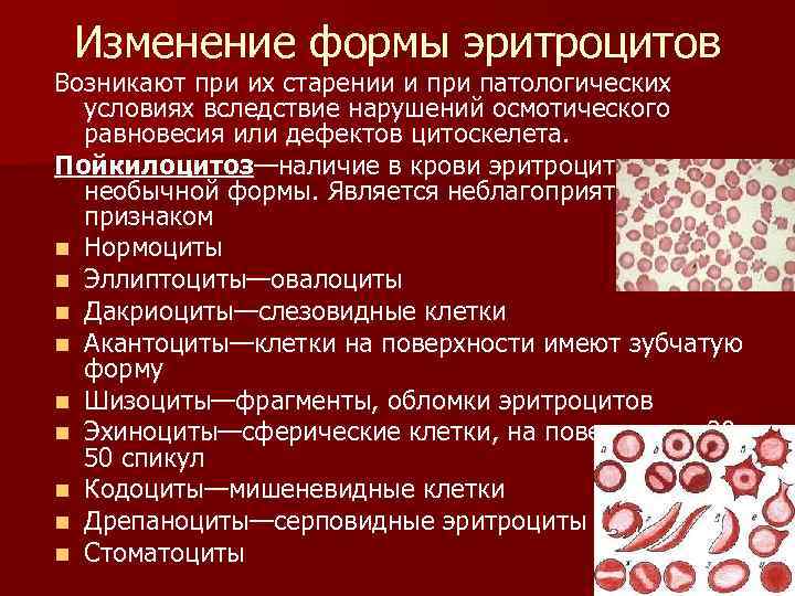 Изменение свойств эритроцитов при тропической малярии. Патологические изменения эритроцитов. Форма эритроцитов. Измененные эритроциты в крови. Изменение формы эритроцитов.