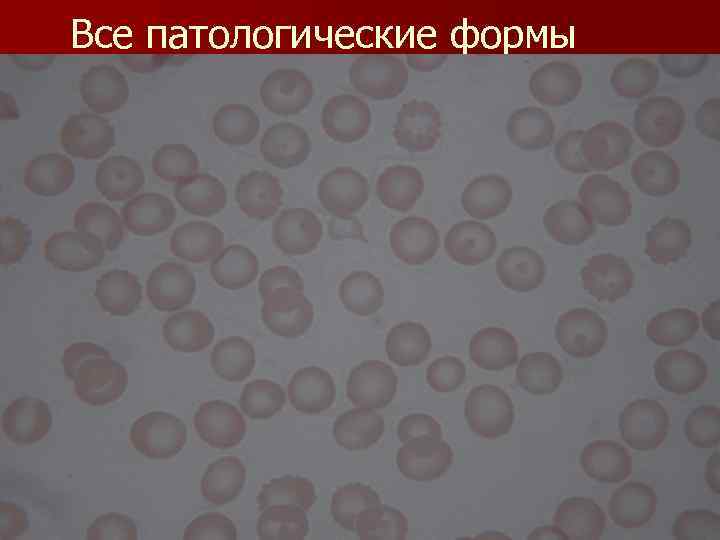 Все патологические формы 