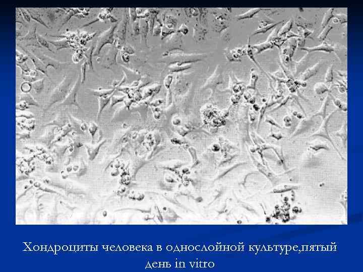 Хондроциты человека в однослойной культуре, пятый день in vitro 