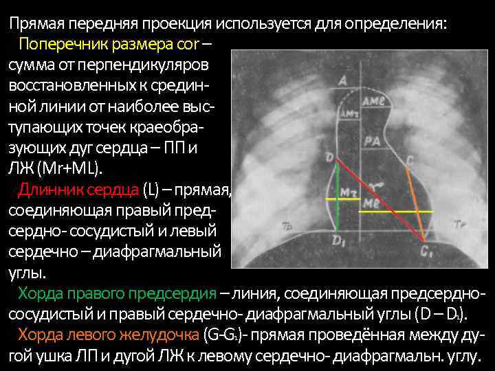 Прямая передняя проекция используется для определения: Поперечник размера cor – сумма от перпендикуляров восстановленных