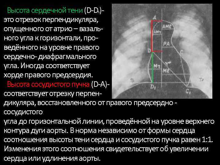 Что означает уплотнения аорты