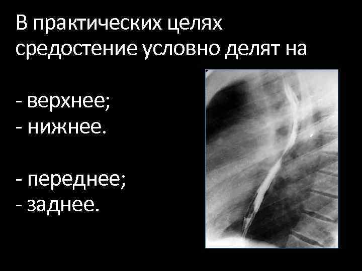 В практических целях средостение условно делят на верхнее; нижнее. переднее; заднее. 