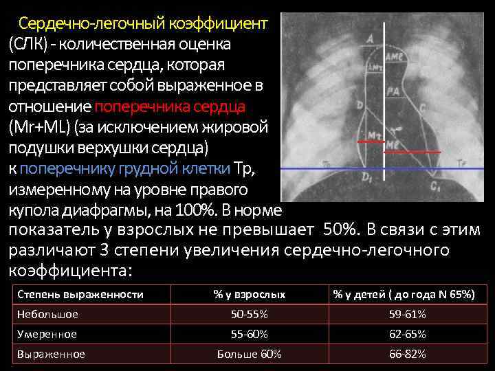 Какой из перечисленных симптомов является ведущим в рентгенологической картине ахалазии пищевода