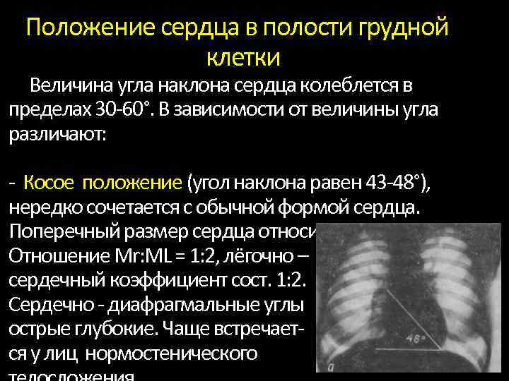 Положение сердца в полости грудной клетки Величина угла наклона сердца колеблется в пределах 30