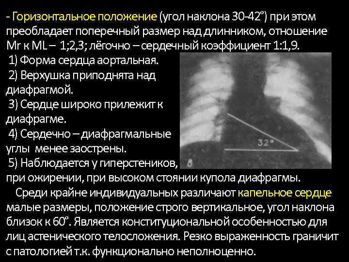 Рентгены анатомия. Горизонтальное положение. Сердечно легочный коэффициент рентгенограмма. Сердечный коэффициент рентген. Угол наклона сердца на рентгене.