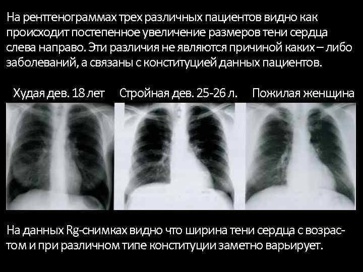 Характеристика изображений на рентгенограммах