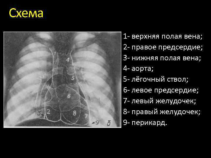 Функция рентгена в айфоне