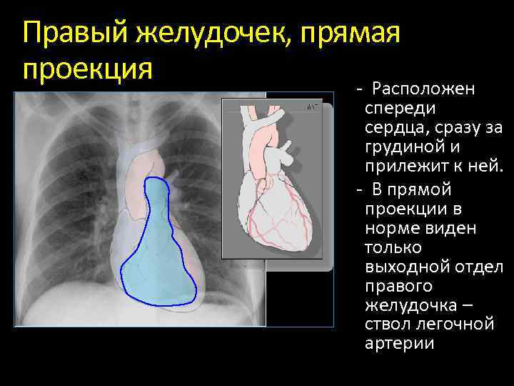 Проекции рентгена