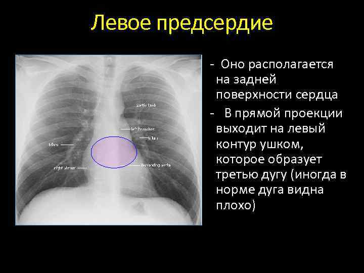 Рентгены анатомия