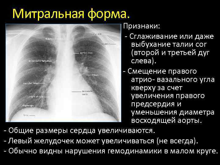 Рентгены анатомия